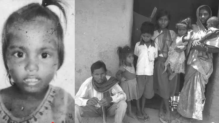 അഞ്ചുവയസുകാരിയുടെ മരണം പട്ടിണി മൂലമെന്ന്​ മാതാപിതാക്കൾ; നിഷേധിച്ച്​ സർക്കാർ