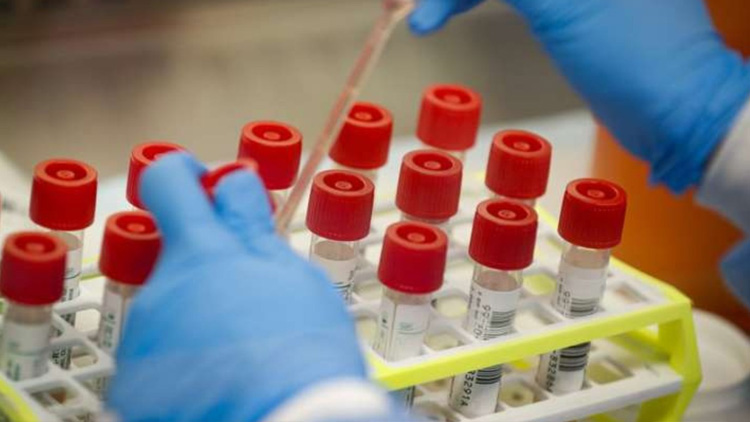 സംസ്ഥാനത്തെ ആദ്യ പ്ലാസ്മ ബാങ്ക് മഞ്ചേരിയിൽ സംസ്ഥാനത്തെ ആദ്യ പ്ലാസ്മ ബാങ്ക് മഞ്ചേരിയിൽ