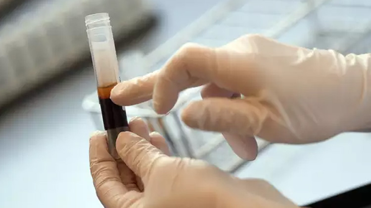 കോവിഡ്: പ്ലാസ്മ തെറപ്പി വിലക്കി കേന്ദ്രം കോവിഡ്: പ്ലാസ്മ തെറപ്പി വിലക്കി കേന്ദ്രം