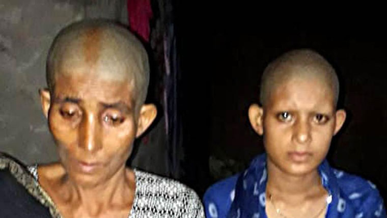 ബലാത്സംഗ ശ്രമം ചെറുത്തു;  അമ്മയെ​യും മകളെയും തലമൊട്ടയടിച്ച്​ തെരുവിലൂടെ നടത്തി