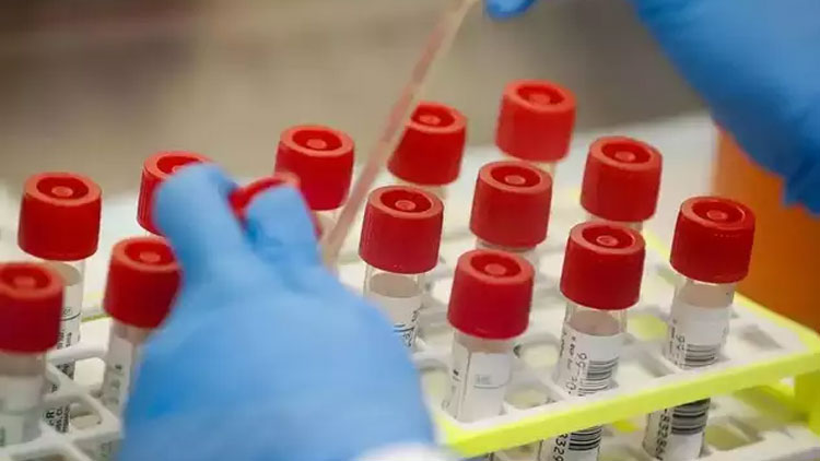 തെറ്റായ പരിശോധനാഫലം; ചൈനീസ്​ റാപ്പിഡ്​ ടെസ്റ്റ്​ കിറ്റുകൾ നിരോധിച്ച്​ പഞ്ചാബ്​ സർക്കാർ