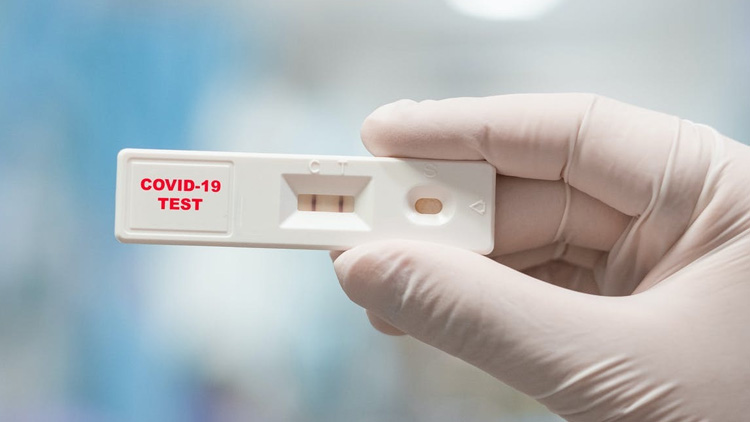 റാപ്പിഡ് ടെസ്റ്റ്: സർക്കാരിെൻറ നിബന്ധന മറികടക്കാമെന്നല്ലാതെ പ്രയോജനമില്ലെന്ന് അനുഭവസ്ഥർ റാപ്പിഡ് ടെസ്റ്റ്: സർക്കാരിെൻറ നിബന്ധന മറികടക്കാമെന്നല്ലാതെ പ്രയോജനമില്ലെന്ന് അനുഭവസ്ഥർ