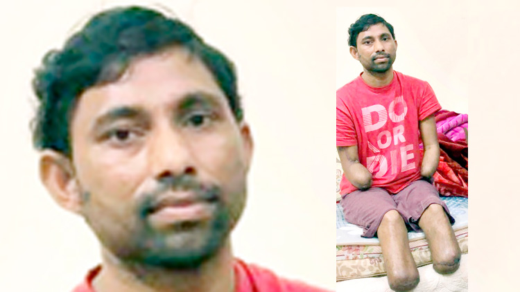 വൈ​ദ്യു​താ​​ഘാ​ത​മേ​റ്റ്​ കൈ​കാ​ലു​ക​ൾ ന​ഷ്​​ട​പ്പെ​ട്ടു; താ​ങ്ങ​റ്റ്​ രേ​ണു​കു​മാ​റി​െൻറ ജീ​വി​തം