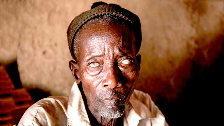 എ​ന്താ​ണ്​ റി​വ​ർ ബ്ലൈ​ൻ​ഡ്​​​നെ​സ്​ൻ​ഡ്​​​നെ​സ്​