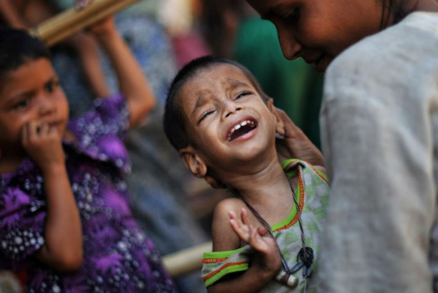 കൊ​ടും​പ​ട്ടി​ണി​യി​ൽ വ​ല​ഞ്ഞ്​ റോ​ഹി​ങ്ക്യ​ക​ൾ