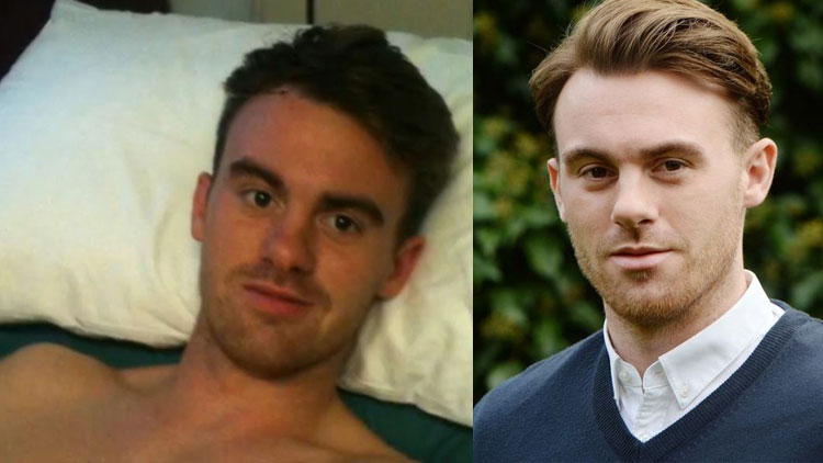 കോമയിൽ നിന്നുണർന്ന ശേഷം ഇംഗ്ലീഷ്​ ഫുട്​ബാളർ സംസാരിച്ചത്​ ചറപറ​ ഫ്രഞ്ച്​