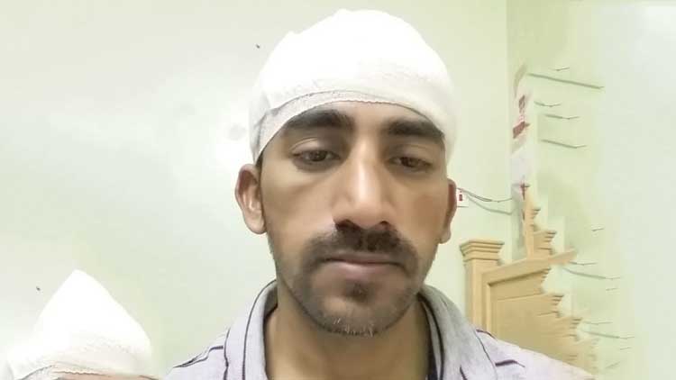 മോഷ്​ടാവ്​ മലയാളിയെ വെട്ടി പരിക്കേൽപിച്ചു