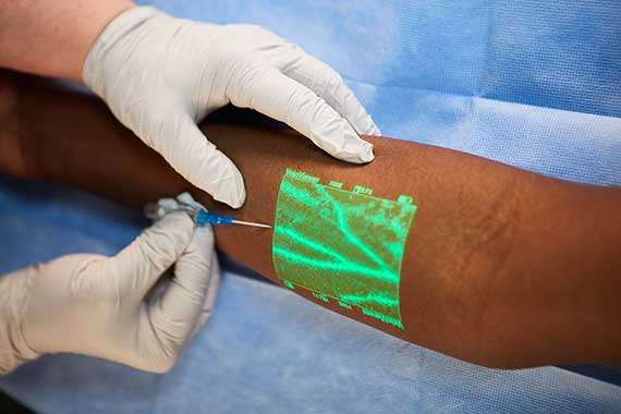 കുത്തിവെക്കാൻ ഞരമ്പുതേടി വല​േയണ്ട; വെയിൻ വ്യൂവർ റെഡി