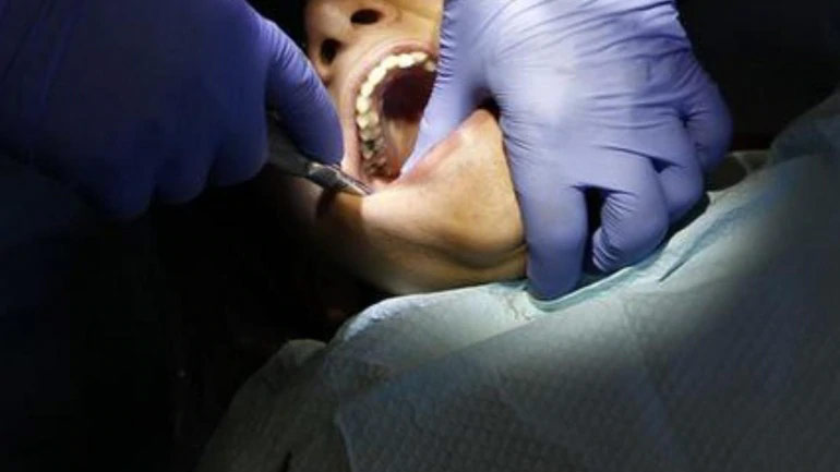 teeth-extract-31719.jpg
